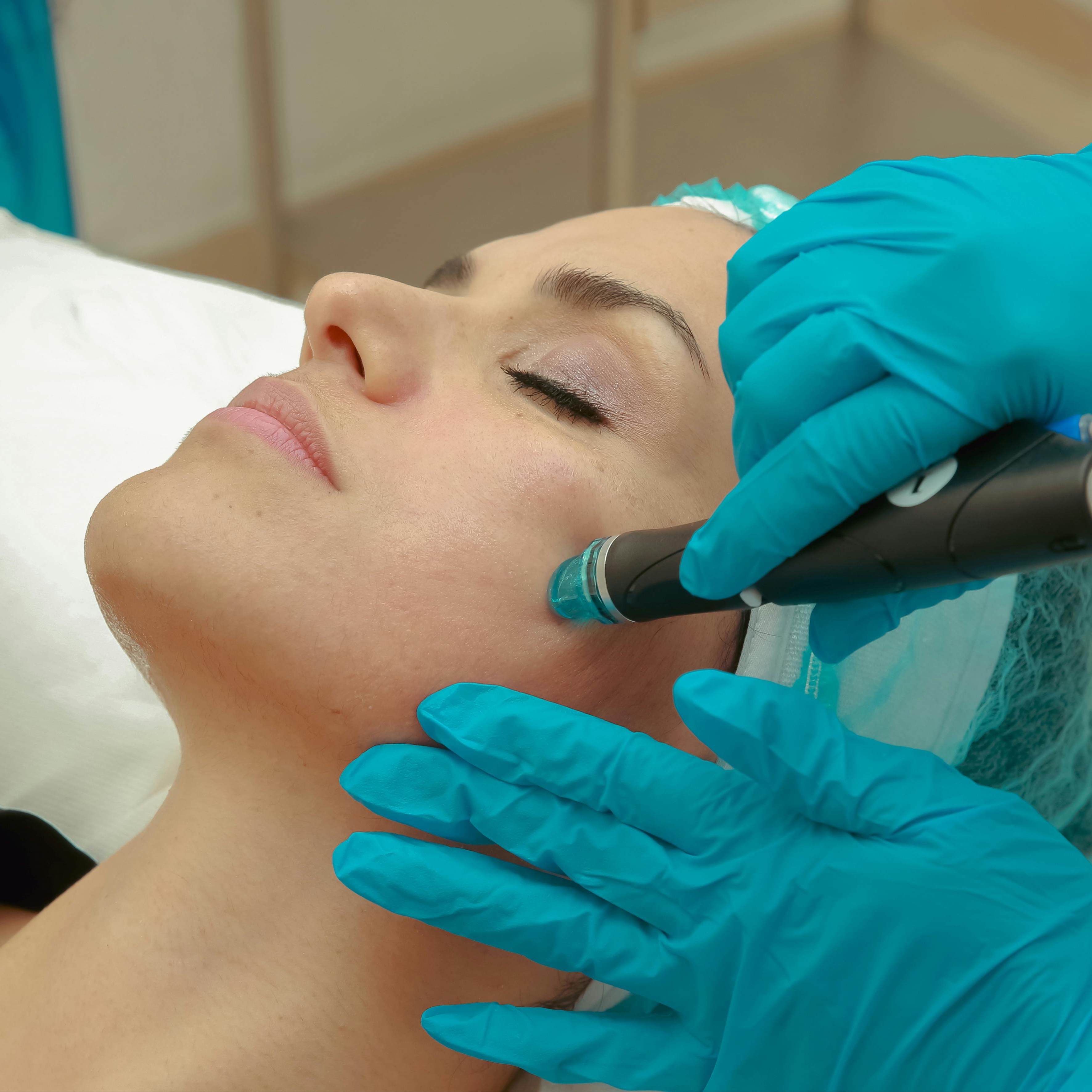 Nano Needling at AETÉRA Spa in Commack, NY