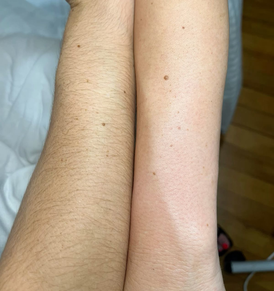 Lower Arm Wax at Brow And Glow by Kathy in Bellflower, CA