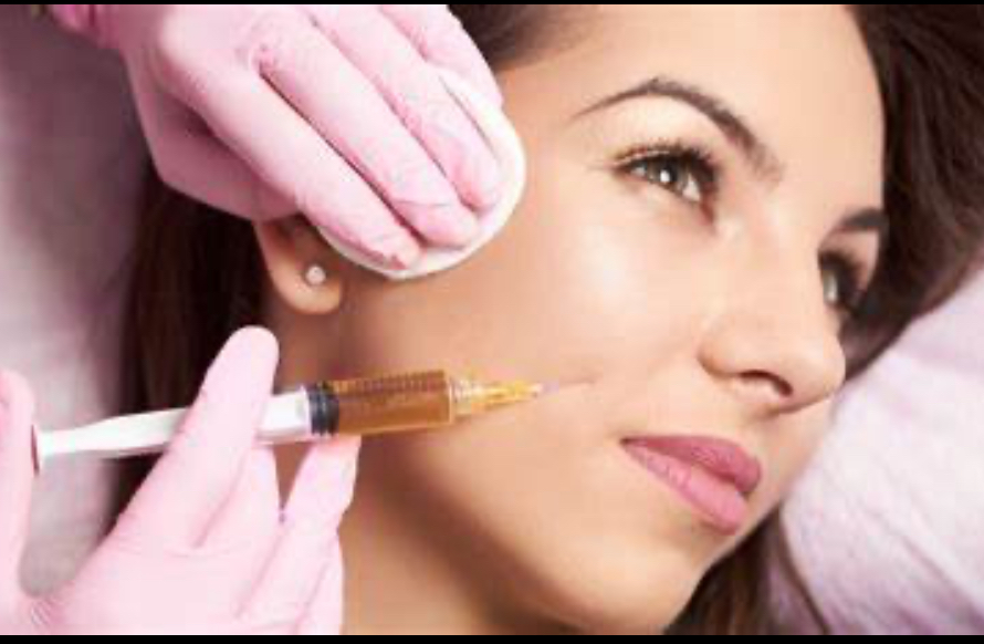 Filler For Smile Lines