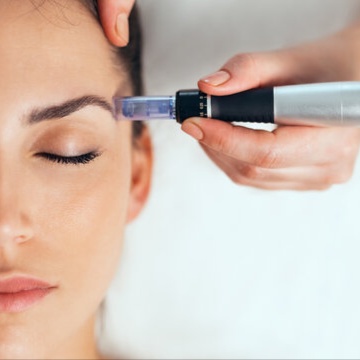 Microneedling at E.V. Aesthetics in Torrance, CA