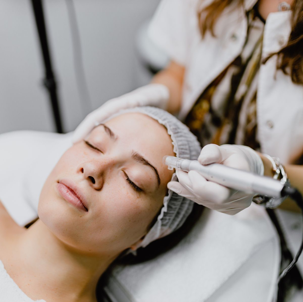THE MICRONEEDLING FACIAL TREATMENT
