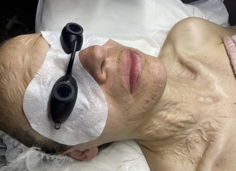 Dermaplane Facial + Lymphatic Face