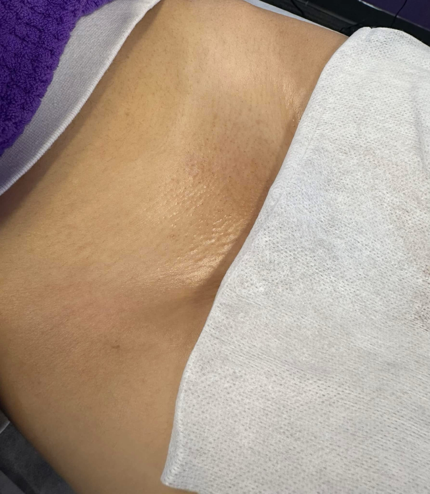 Brazilian Wax