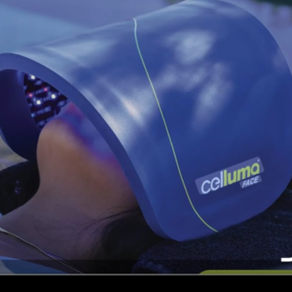 Blue Light Acne Therapy at Glowing Results Skin Spa in Cape Coral, FL