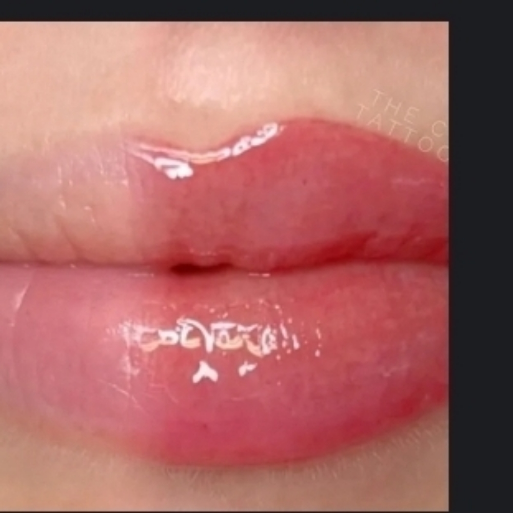Hydra Lips at Skin & Toxx Medical Spa Westchase in Houston, TX
