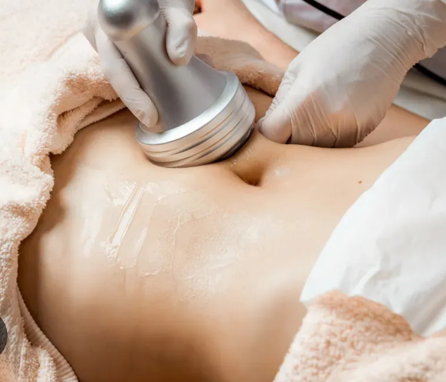 Sculpturas | Mommy makeover