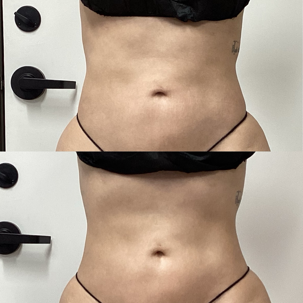 Total Body Lymphatic Reset at Bodies by Claudia in Westminster, CO