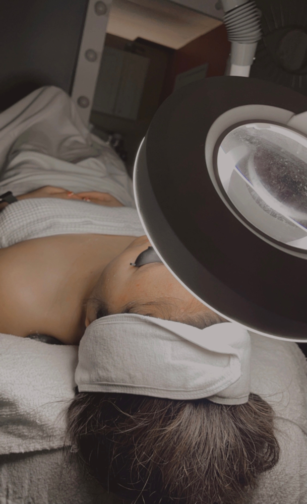 Microneedling Facial