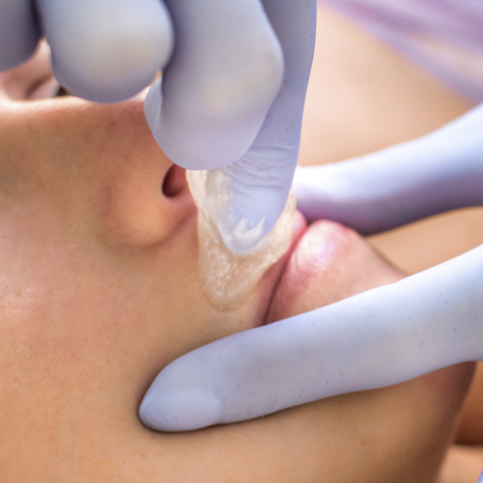 Upper Lip at Bare Beauty Esthetics in Las Vegas, NV
