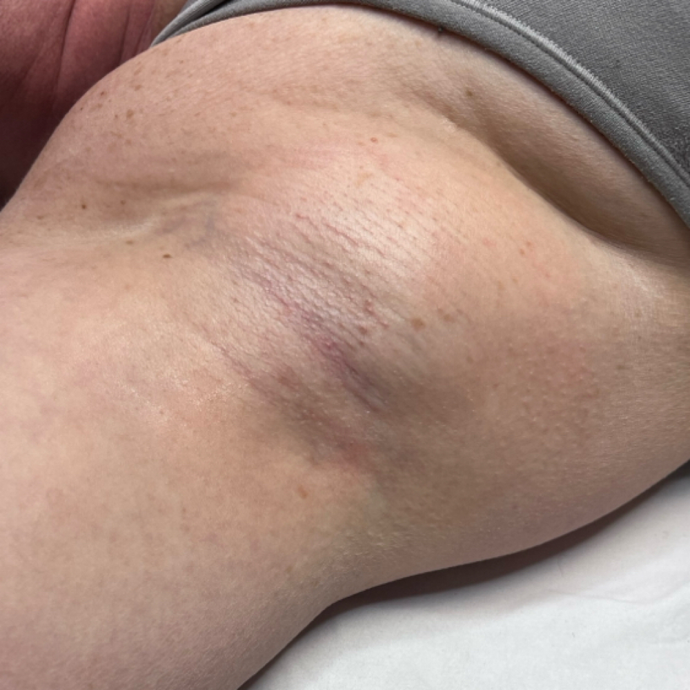 Underarm Wax at The Radiance Roomm in Redmond, OR