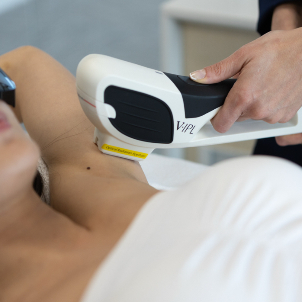 Under Arm Laser Hair Removal at 369 Aesthetics in Burlington, IA