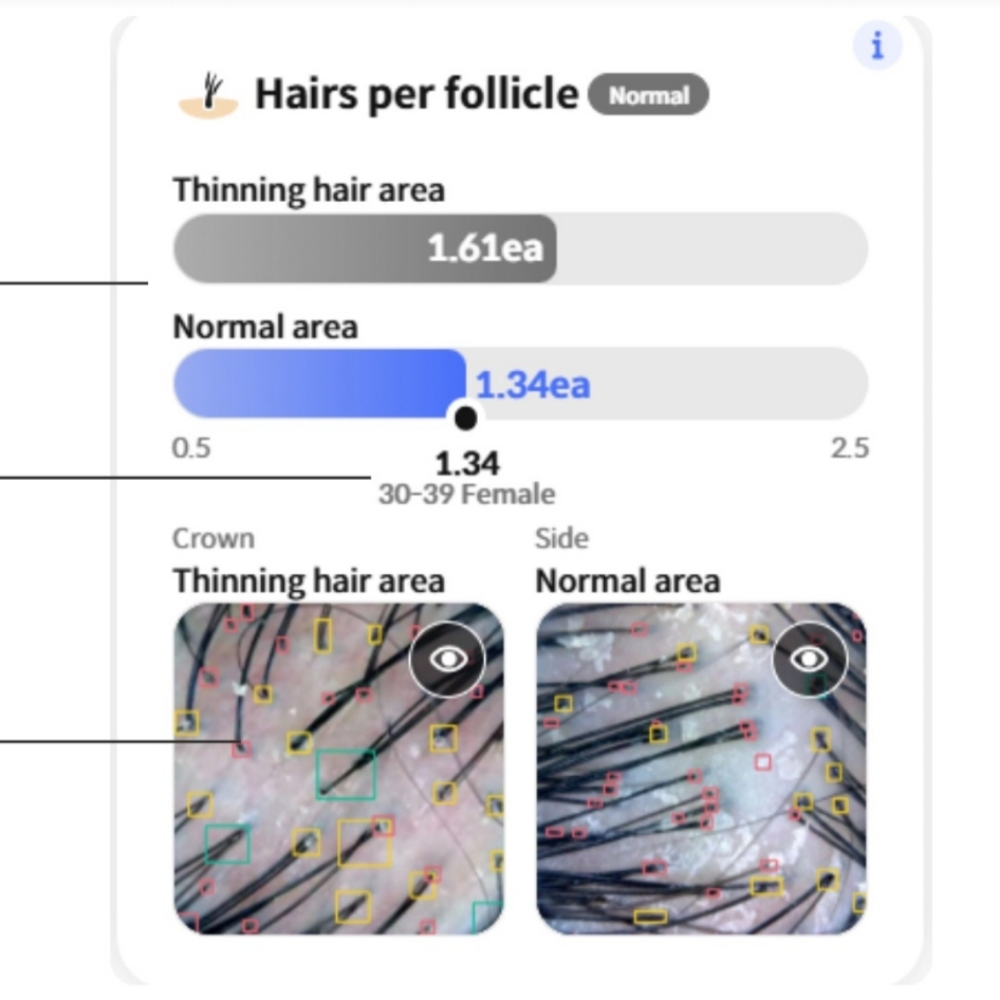 The Thrive Hive Trichoscopy at Thrive Hive Holistic in McKinney, TX