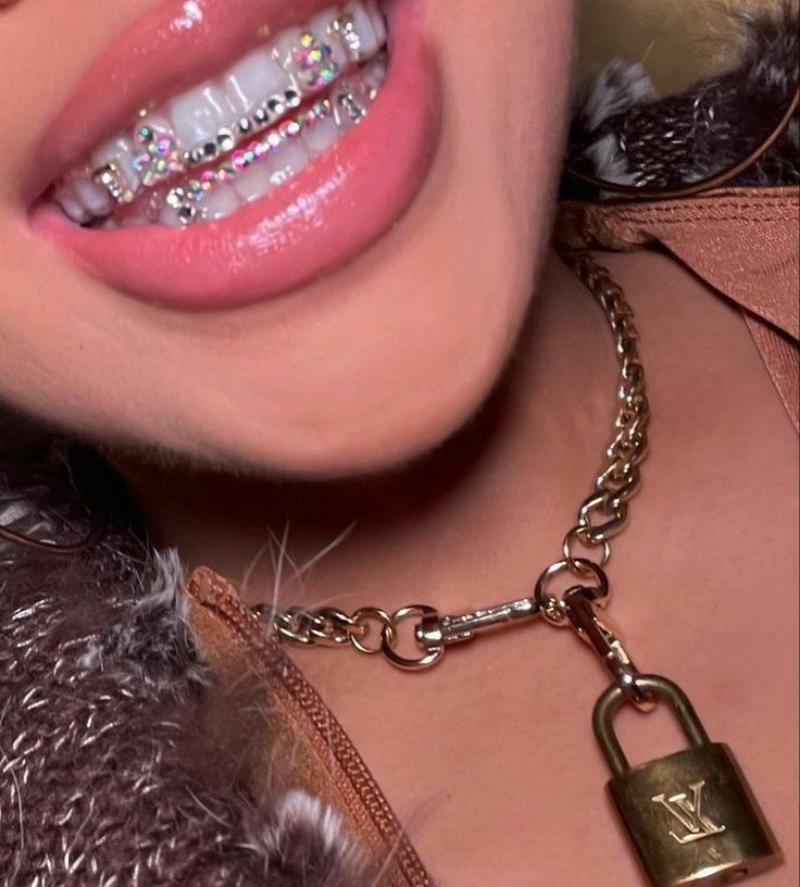 Freestyle Tooth Gems