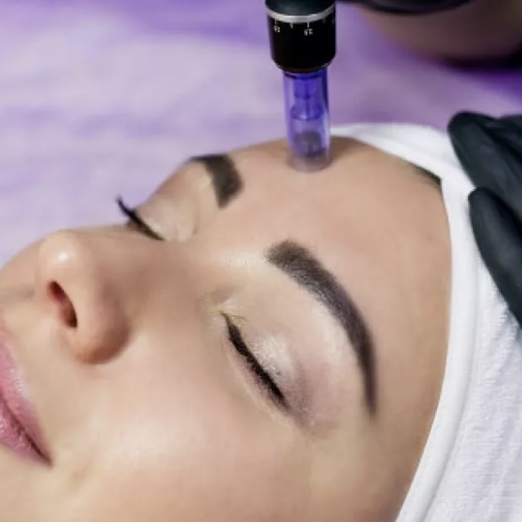 Microneedling