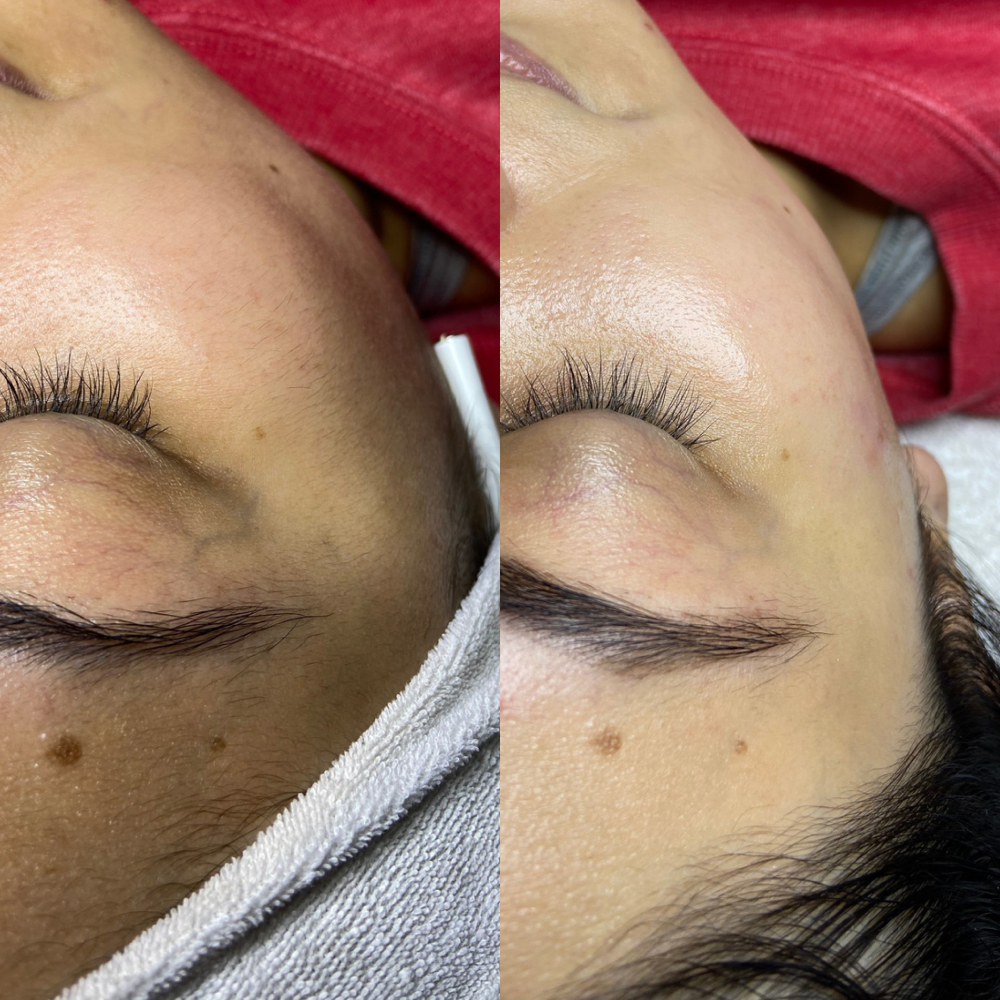 Custom Facial at Bella By Magali in Rogers, AR