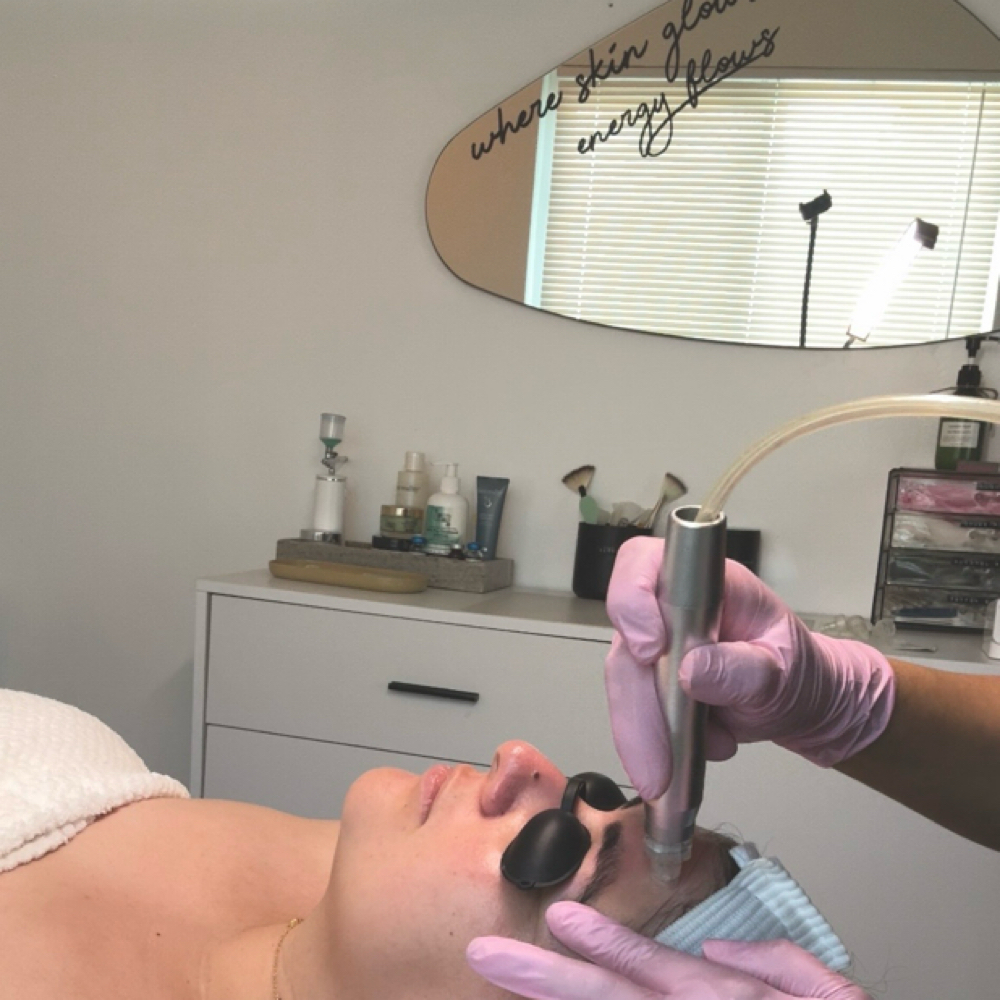 Hydro Facial at Karla Espinoza in Downey, CA