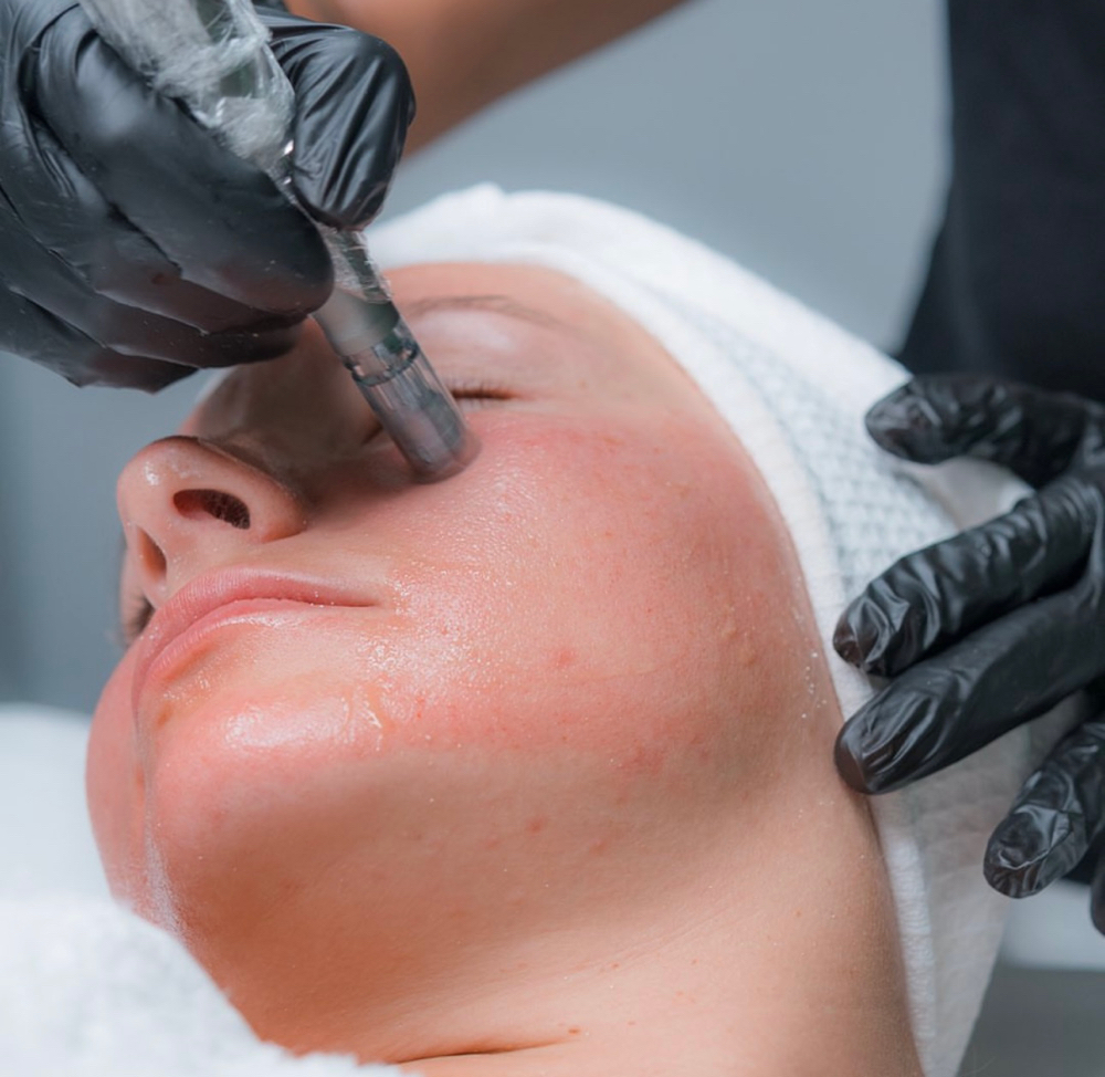 The Diamond Facial at Accentuated Beauty in Corpus Christi, TX