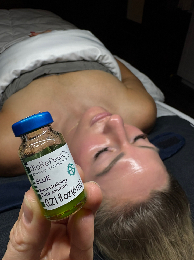 Biorepeel at SOULFUL SKIN CO. in Columbus, OH