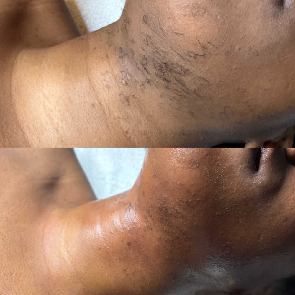 Chin & Lip Wax at Ethereal Skin x Jenn in Bloomfield, NJ