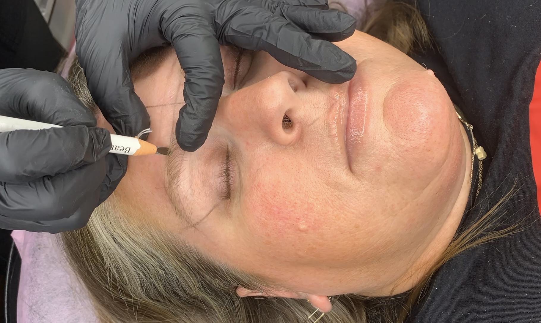 Brow Consultation