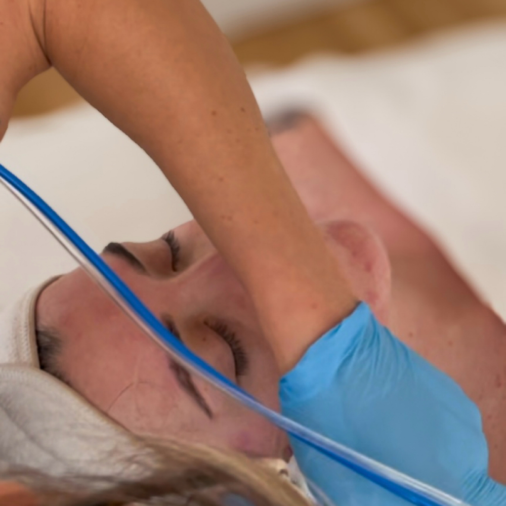 Hydro-Dermabrasion Luxe Experience