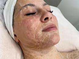 Skin service-firming peptide+enzyme