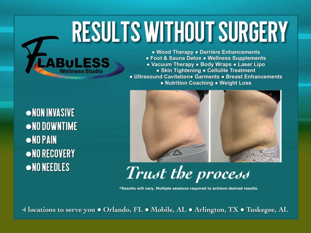 Flabuless 3D Laser Lipo Treatment