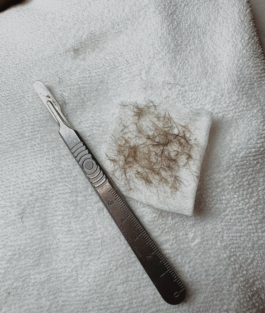 Dermaplane Add On