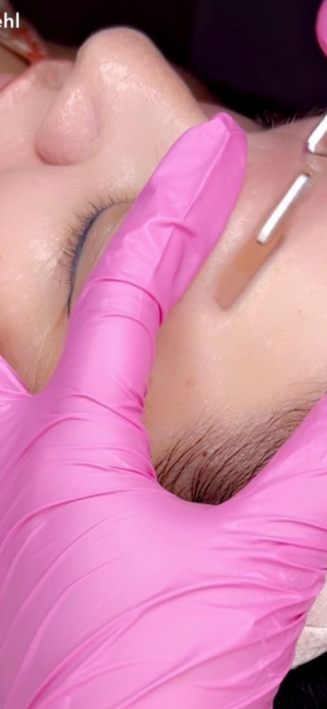 Dermaplaning Facial