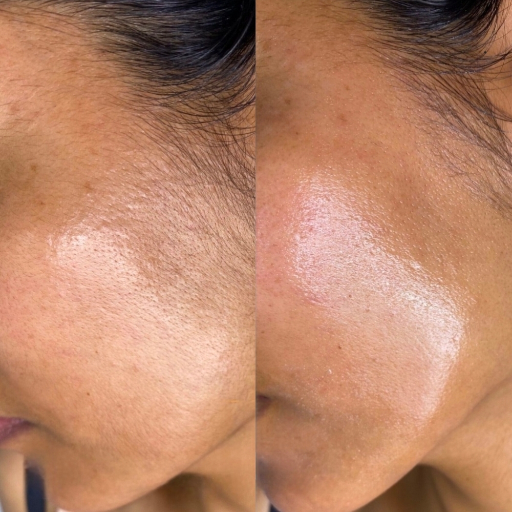 Ethereal Embrace Facial