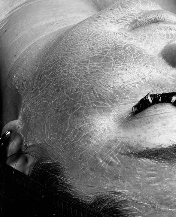 AE SKIN TIGHTENING FACIAL