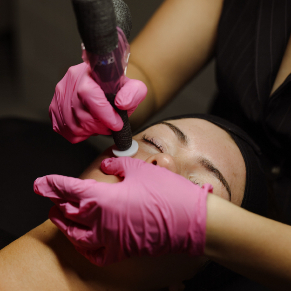 Microchanneling Package at Lady Mae Esthetic’s in Redmond, OR