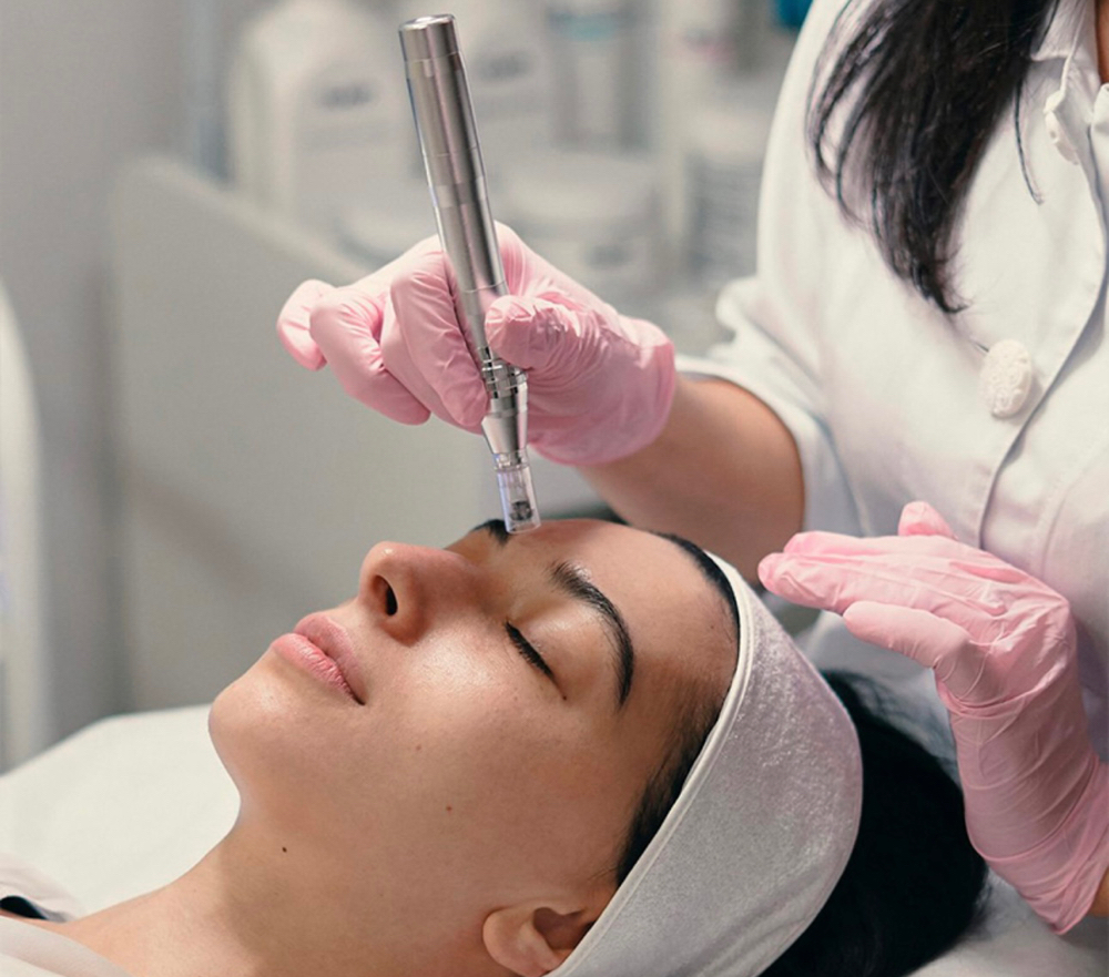 Detox + Microneedling