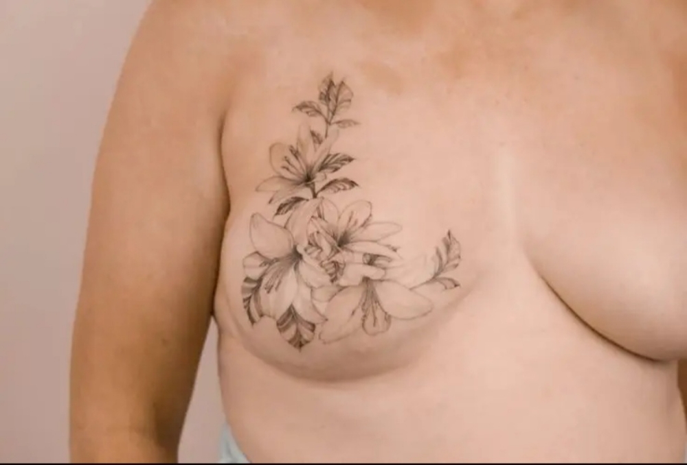 Decorative Areola
