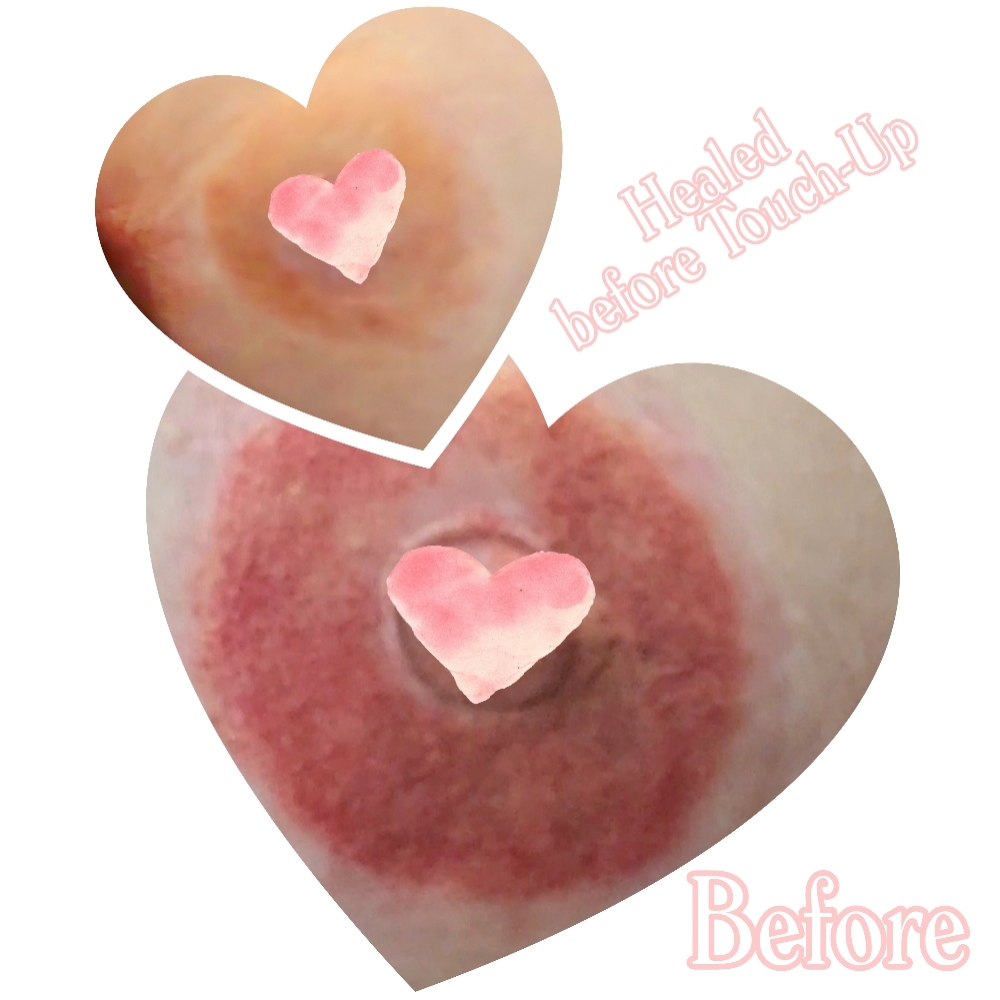 3D Areola Restorative Tattoo at Carole's Cosmetic Tattoo in Beaverton, OR