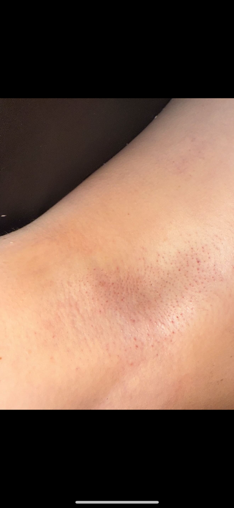 Bare&Bloom Underarm at Bare&bloom wax in Gansevoort, NY