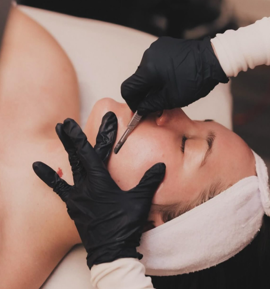 Dermaplane Facial