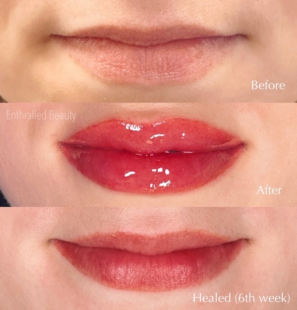 Lip Correction Touch Up (6-8weeks)