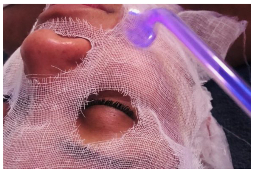 Topnotch Signature Facial