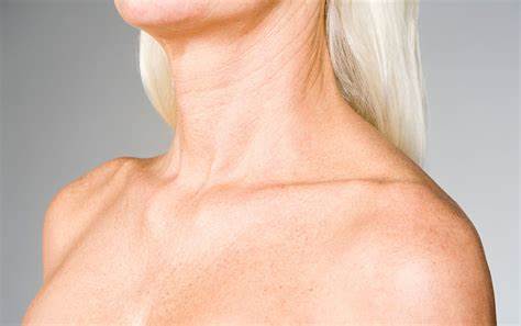 Add On: Neck or Decollete Peel