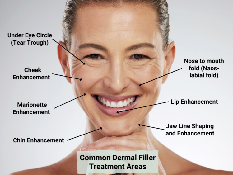 Dermal Filler Injections