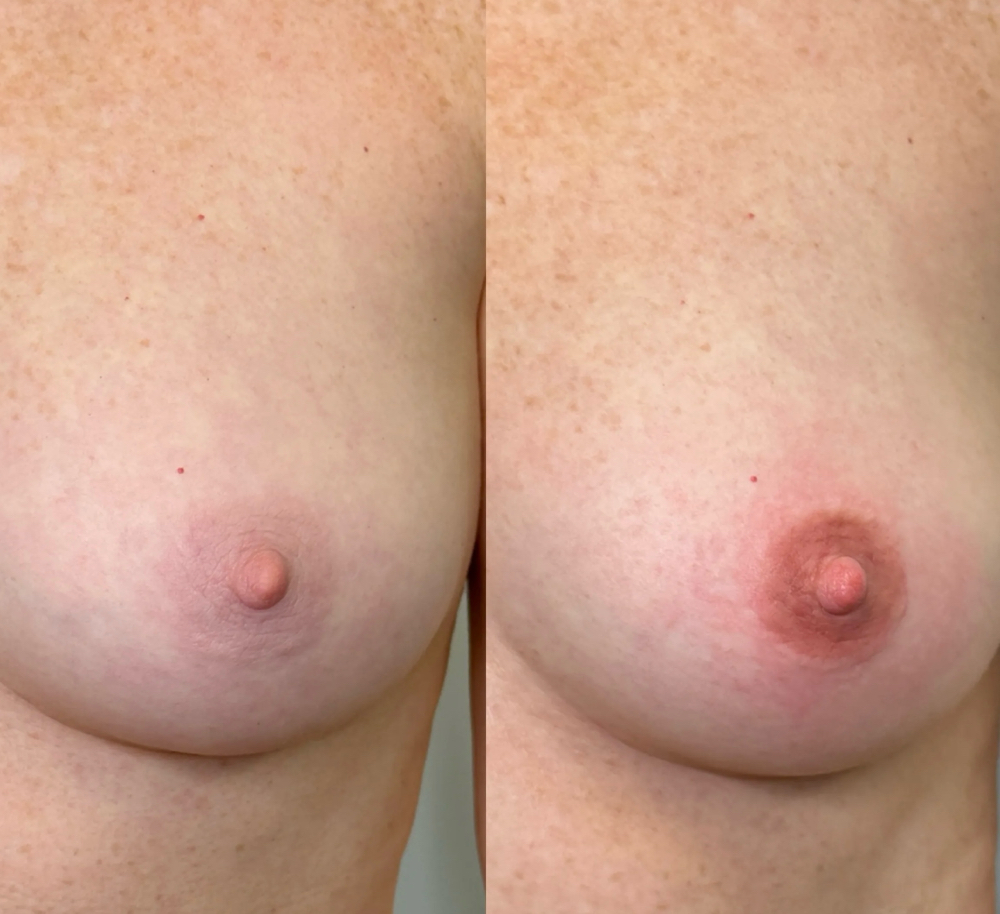 Nipple Blush