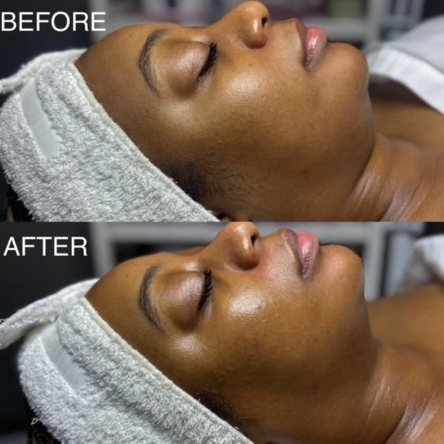 Hydrating Facial 60 min at BK Skin & Brow Co. in Saint Charles, IL