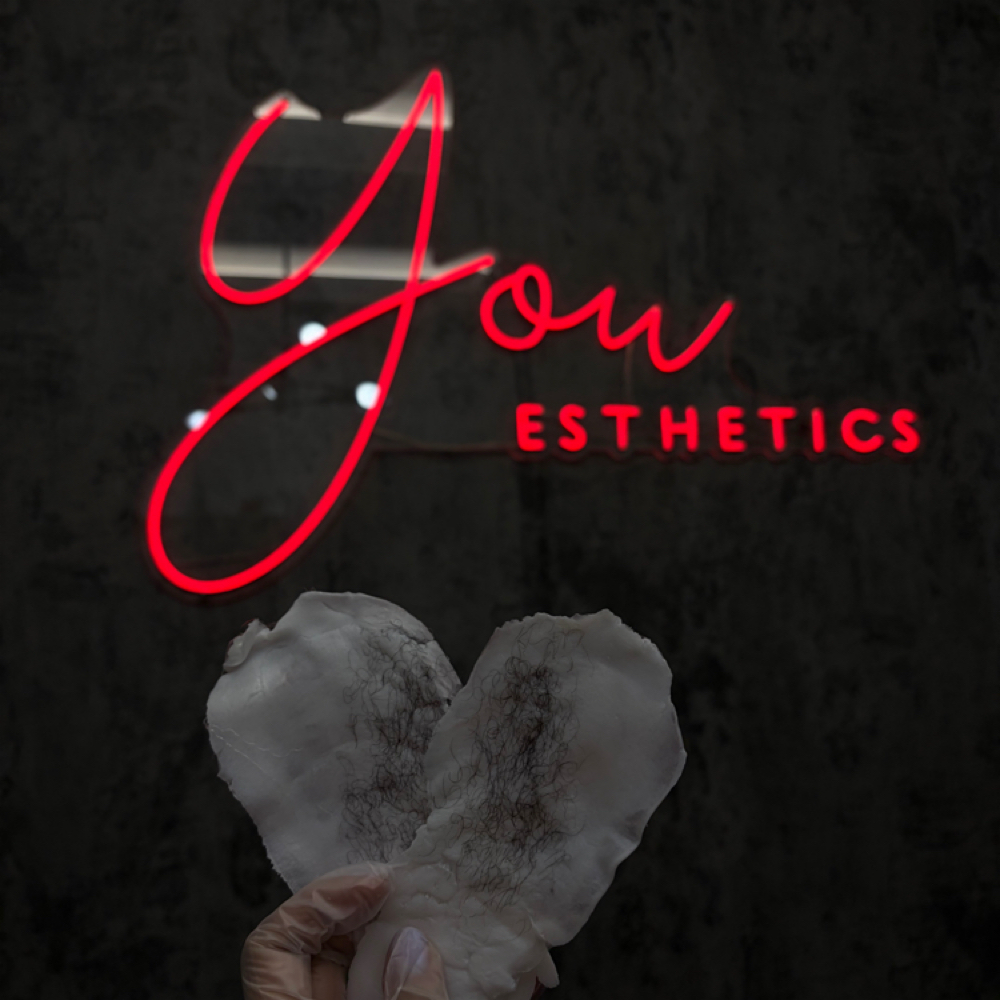 The Signature Full Upper Body Exper at You Esthetics in Salem, MA