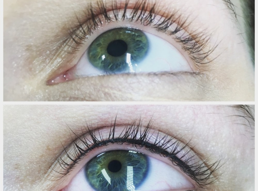 Lash Enhancements