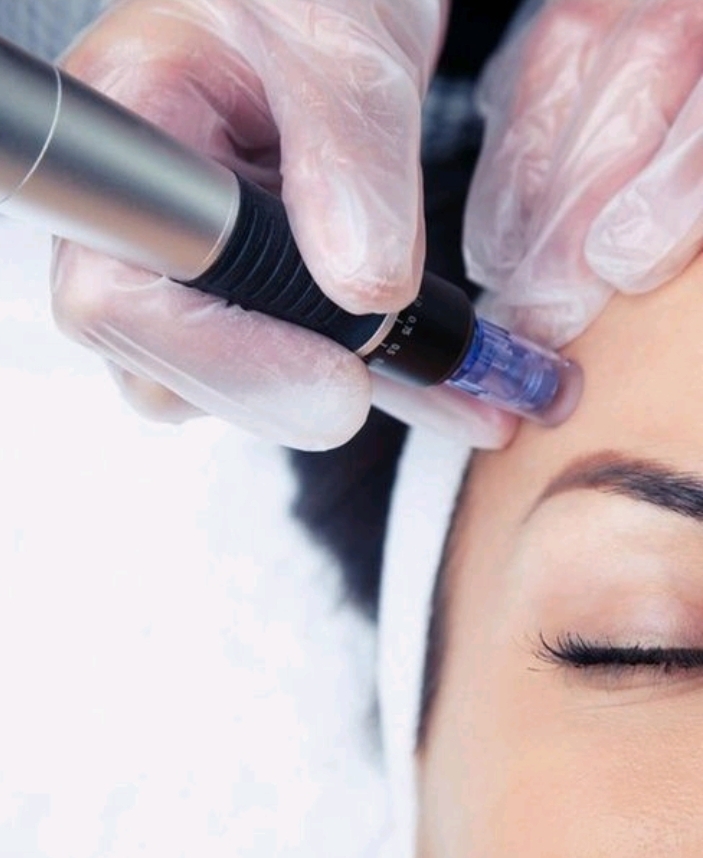 Microneedling W/ Led/ Microcurrent