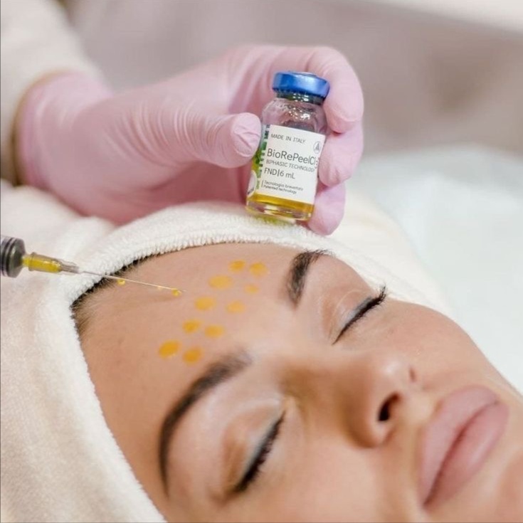 BioRePeel Treatment at LUYA BEAUTY LAB in Sarasota, FL