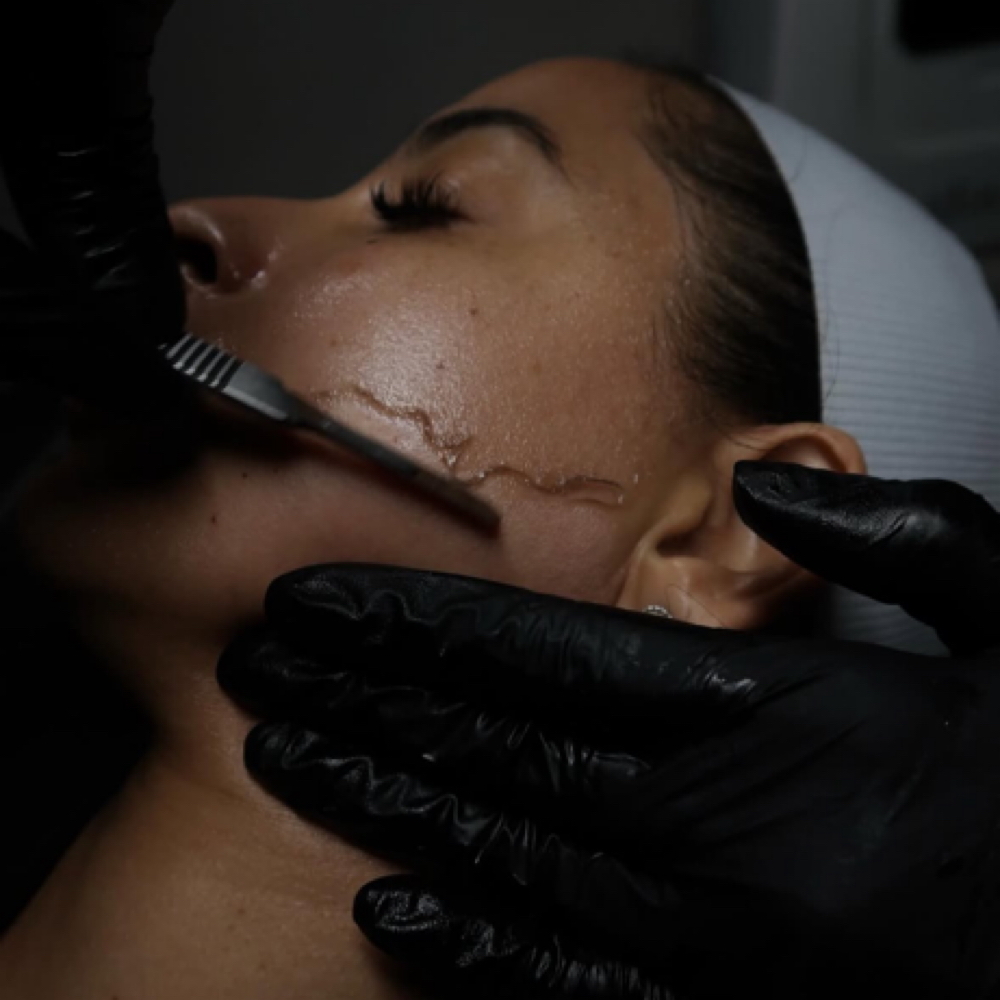 Dermaplane Facial at The BOB Salon in Fort Wayne, IN