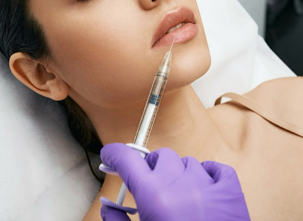 Lip Filler - Full Syringe