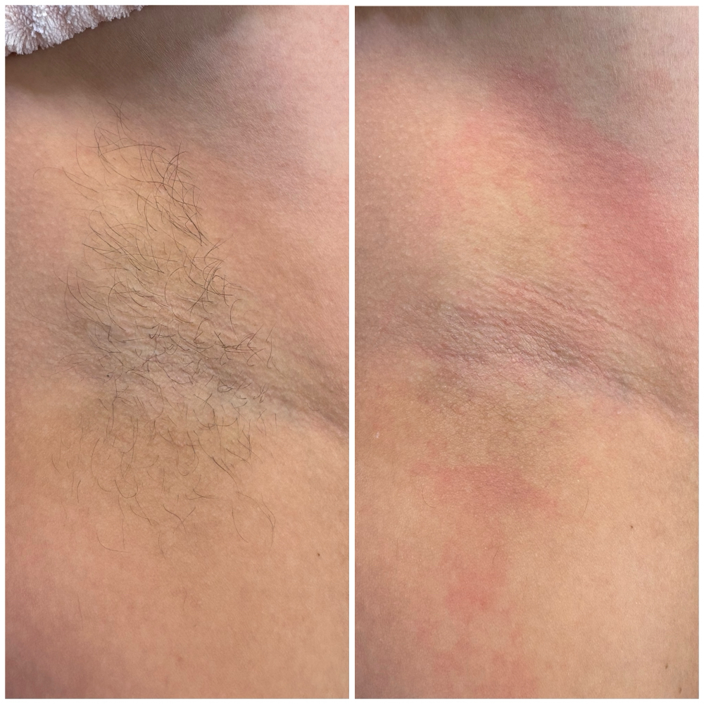 Underarm Wax at BROWZ_BY_BETZY in Newburgh, NY